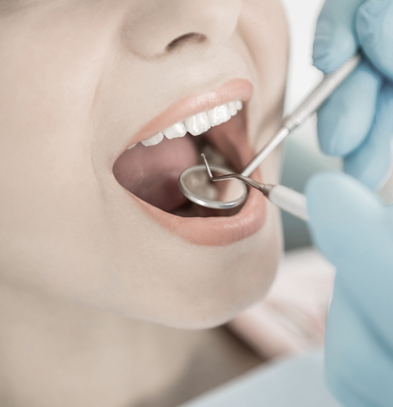 口腔外科(拔智齒)